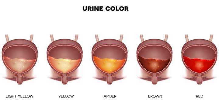 Normal Urine Color: Many Different Shades