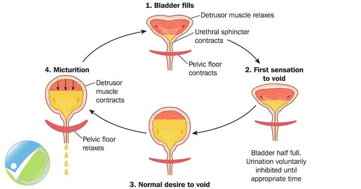 Overactive Bladder: Types, Symptoms, Causes, Diagnosis And ...