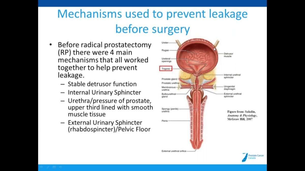 Pelvic Floor Muscle Training To Improve Urinary Incontinence After ...