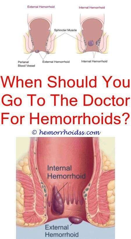 Pin on How to Get Rid Of Hemorrhoids
