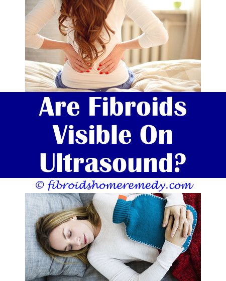 Pin on Uterine Fibroids Treatment