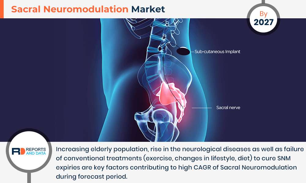 Sacral Neuromodulation Market To Reach USD 3.3 Billion By 2027 ...