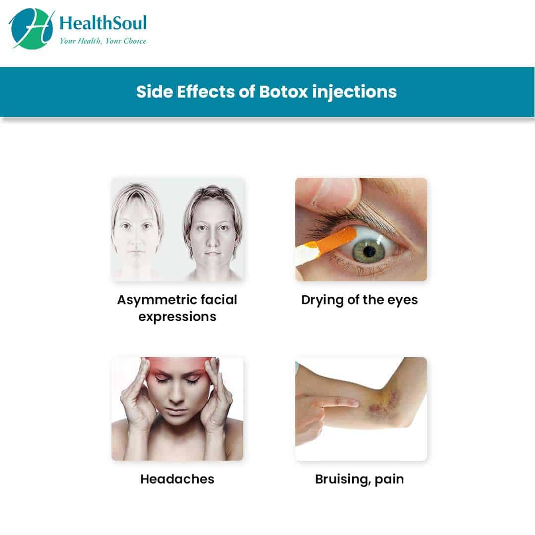 Side Effects Of Bladder Botox Injections
