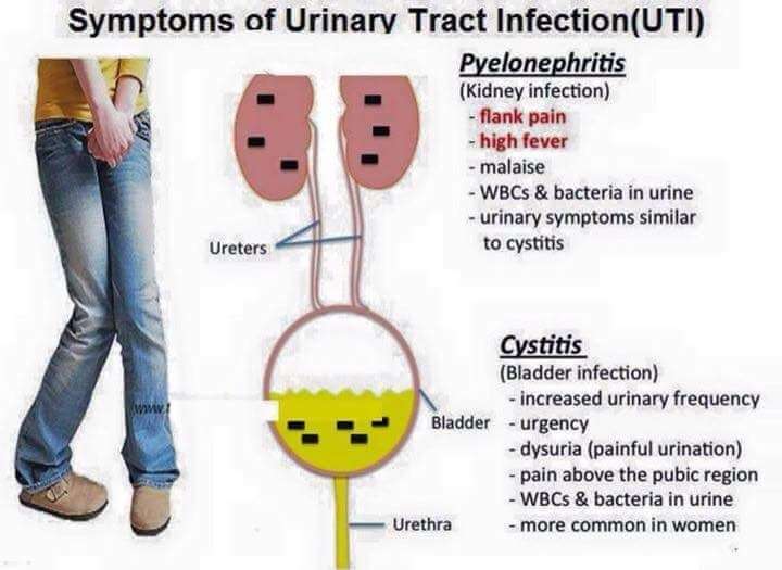 symptoms of urinaty tract infection (UTI)
