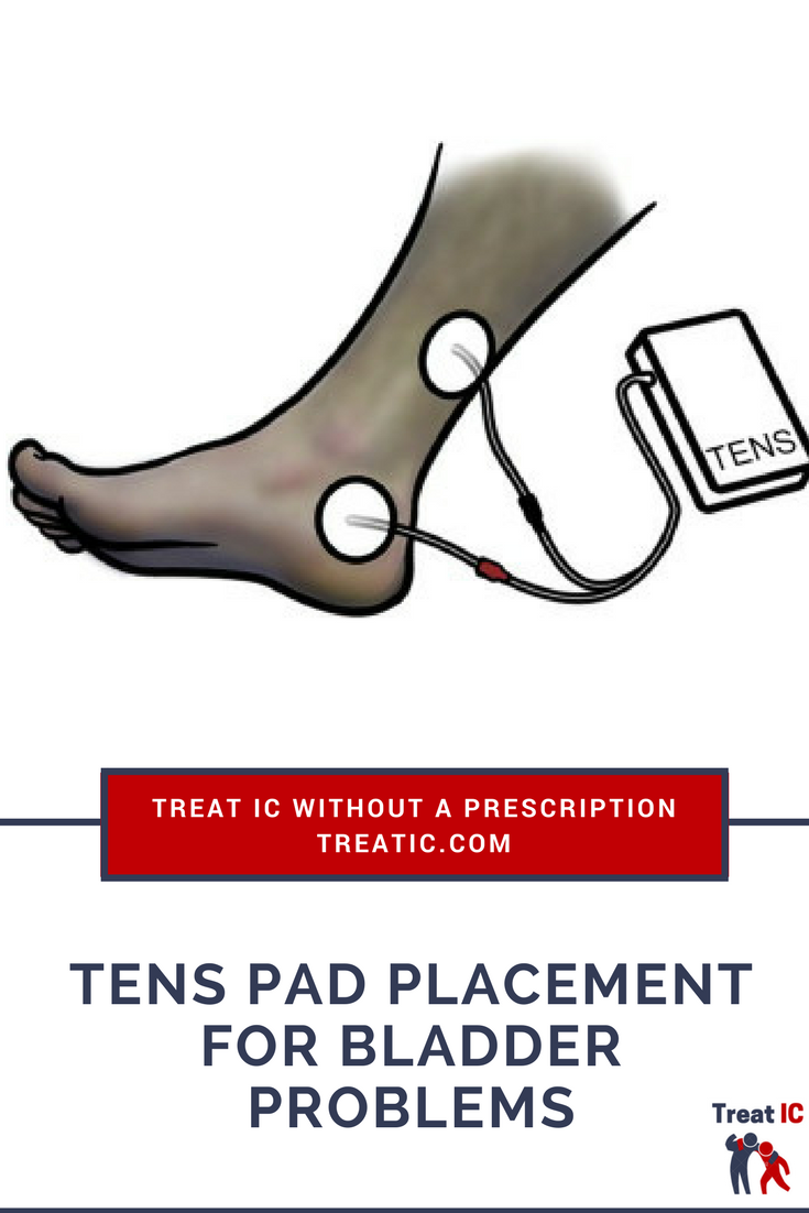 TENs placement for IC: help with bladder urgency and ...