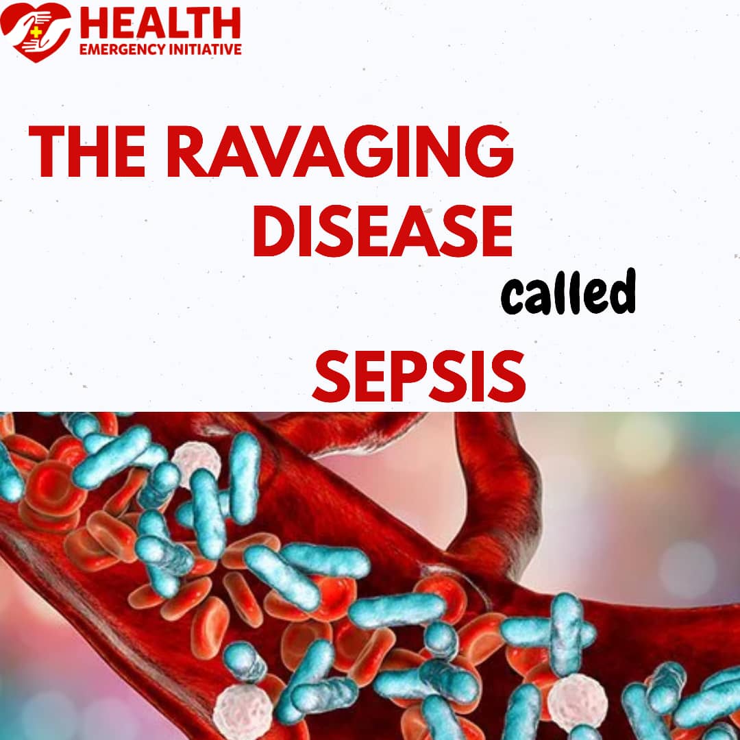 The Ravaging Disease Called Sepsis II