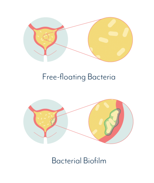 The Role Of Biofilms In Chronic UTIs  Native Formulas