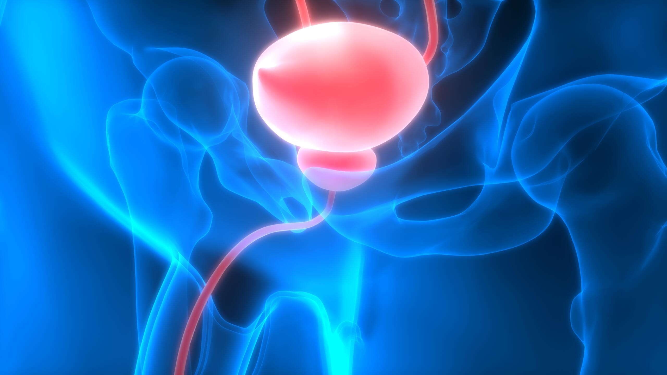 The Signs and Symptoms of Bladder Cancer