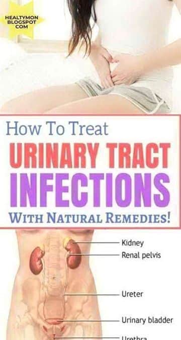 Treat UTI with these natural remedies #naturalremedies #homemaderemedy ...