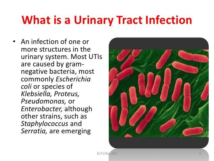 Urinary tract infection , Clinical Based learning