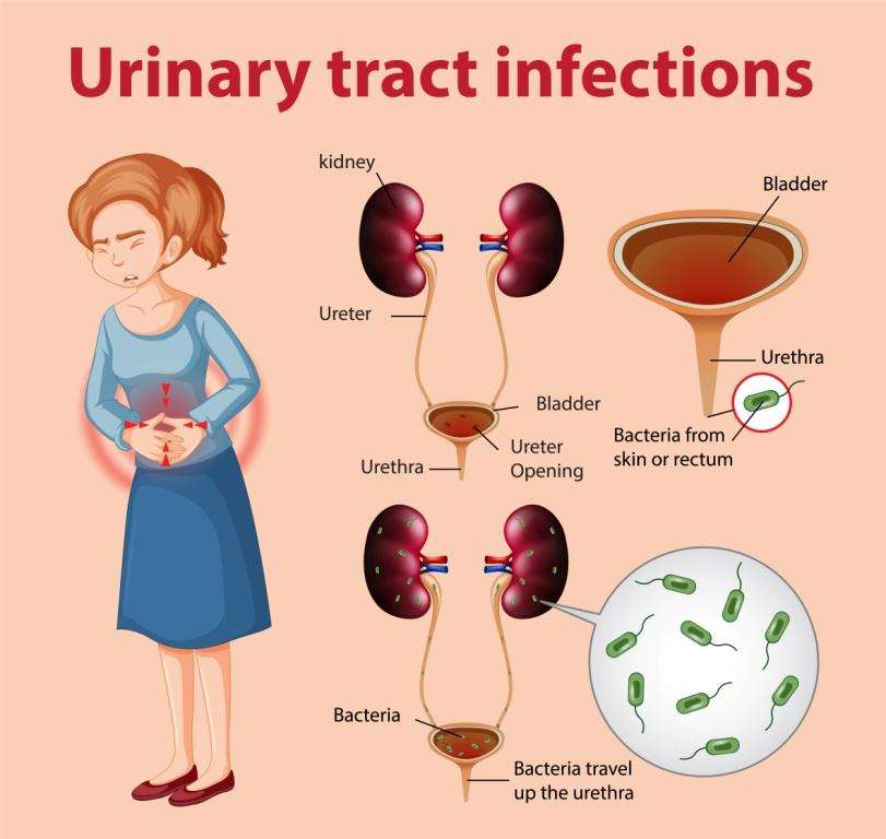 Urinary Tract Infections &  Kidneys
