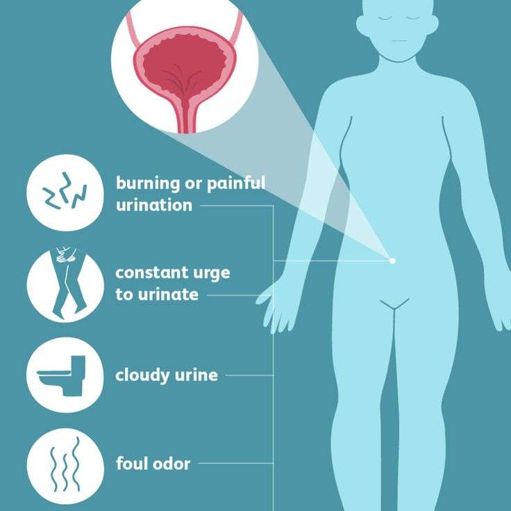 Urinary Tract Infections: Symptoms and ...