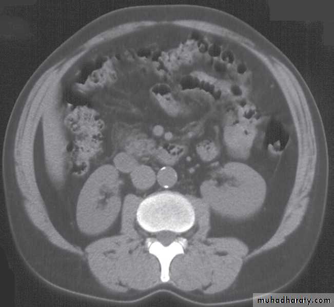 urinary tract radiology 1 ppt pptx