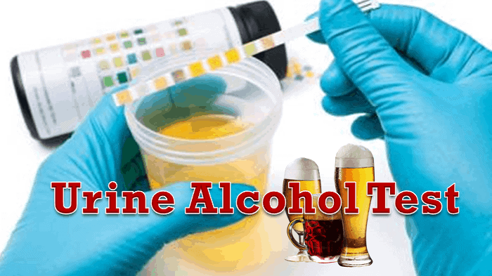 Urine Alcohol Test