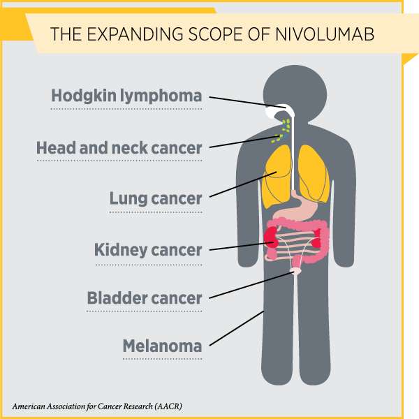 Use of Nivolumab Expanded to Sixth Cancer Type