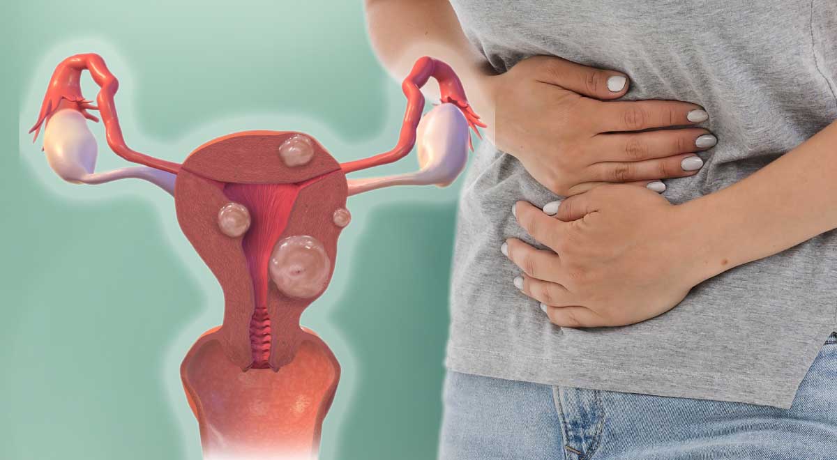 Uterine Fibroids Symptoms and Risk Factors You Should be ...