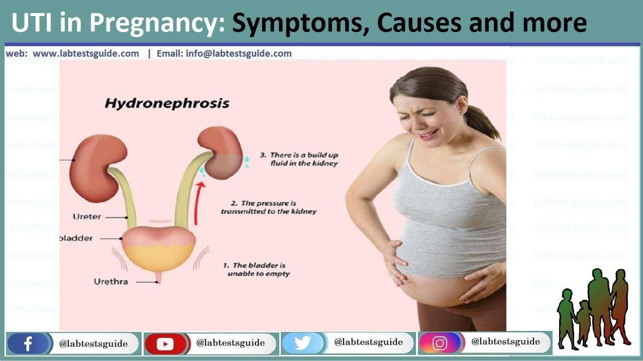 UTI in Pregnancy: Symptoms, Causes and more
