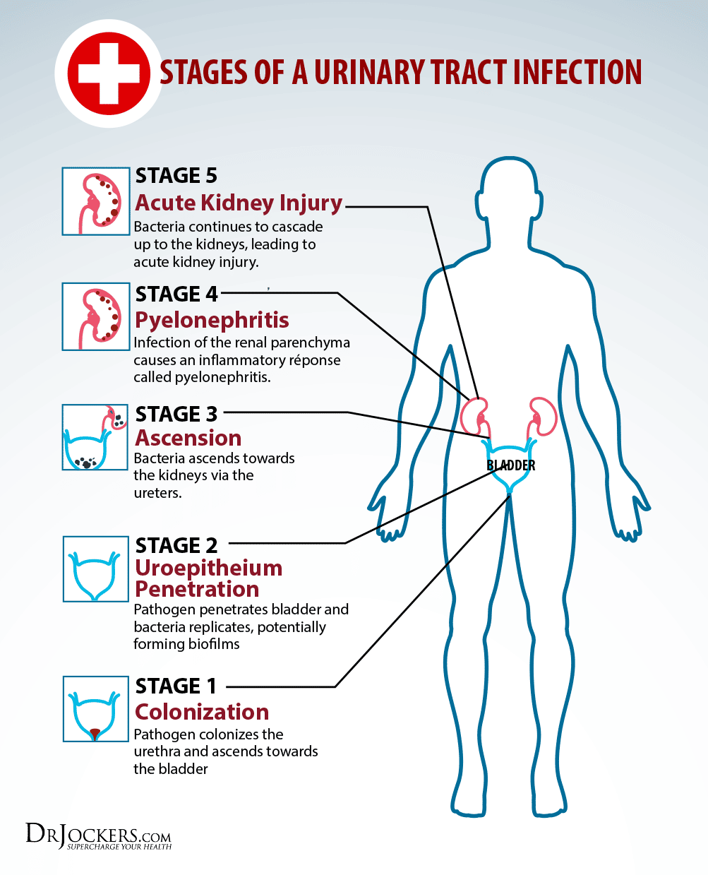 Uti Symptoms Vs Kidney Infection