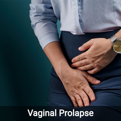 Vaginal Prolapse â Symptoms, Causes, Diagnosis &  Treatment