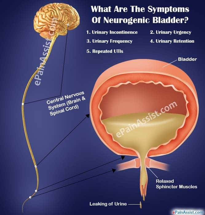 What Are The Symptoms Of Neurogenic Bladder?