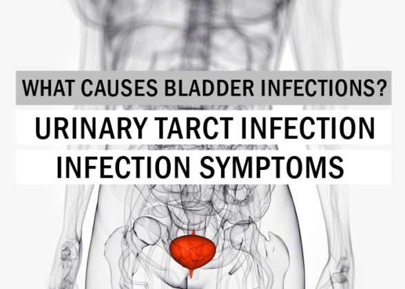 What Causes Bladder Infections? Urinary Tract Infection ...
