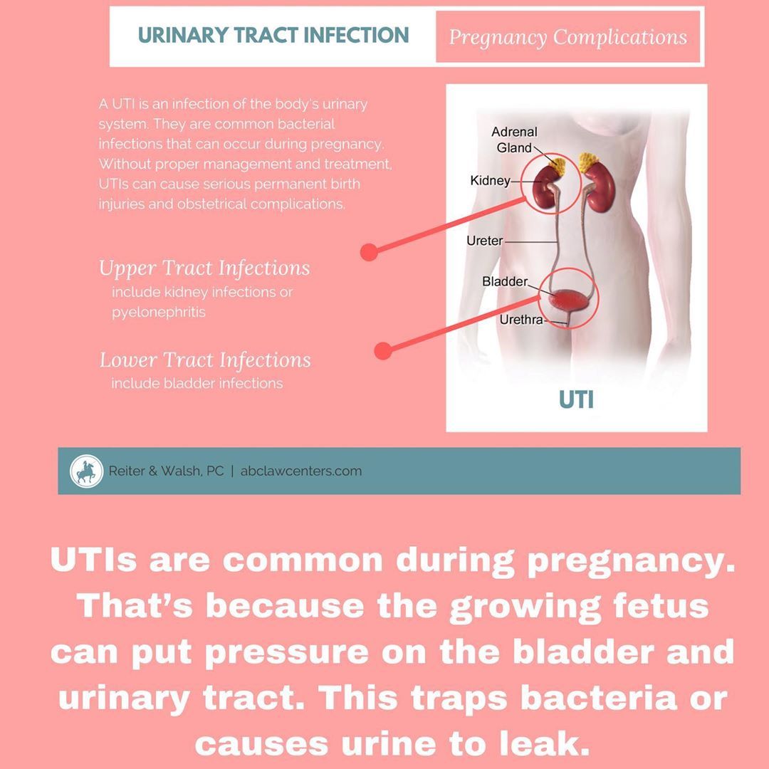 What Causes Uti In Pregnancy