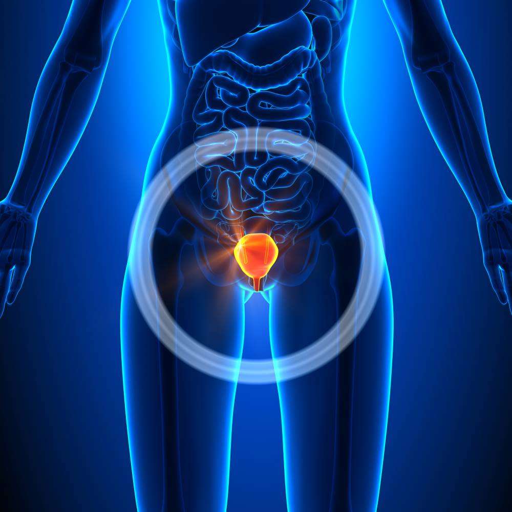 What is a Bladder Sling Procedure?