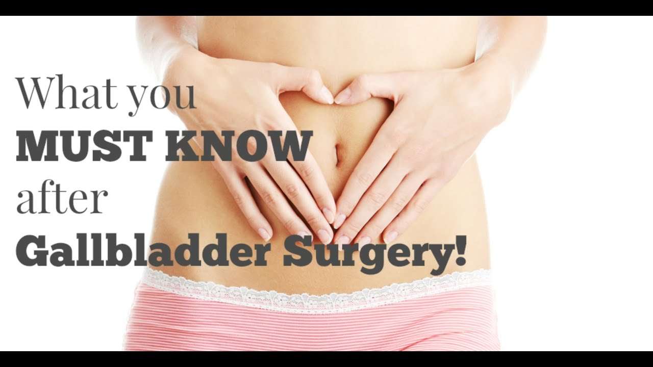 What to do after Gallbladder Surgery