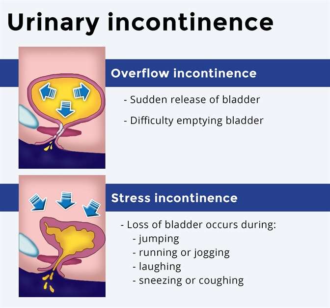 What to know: urinary incontinence