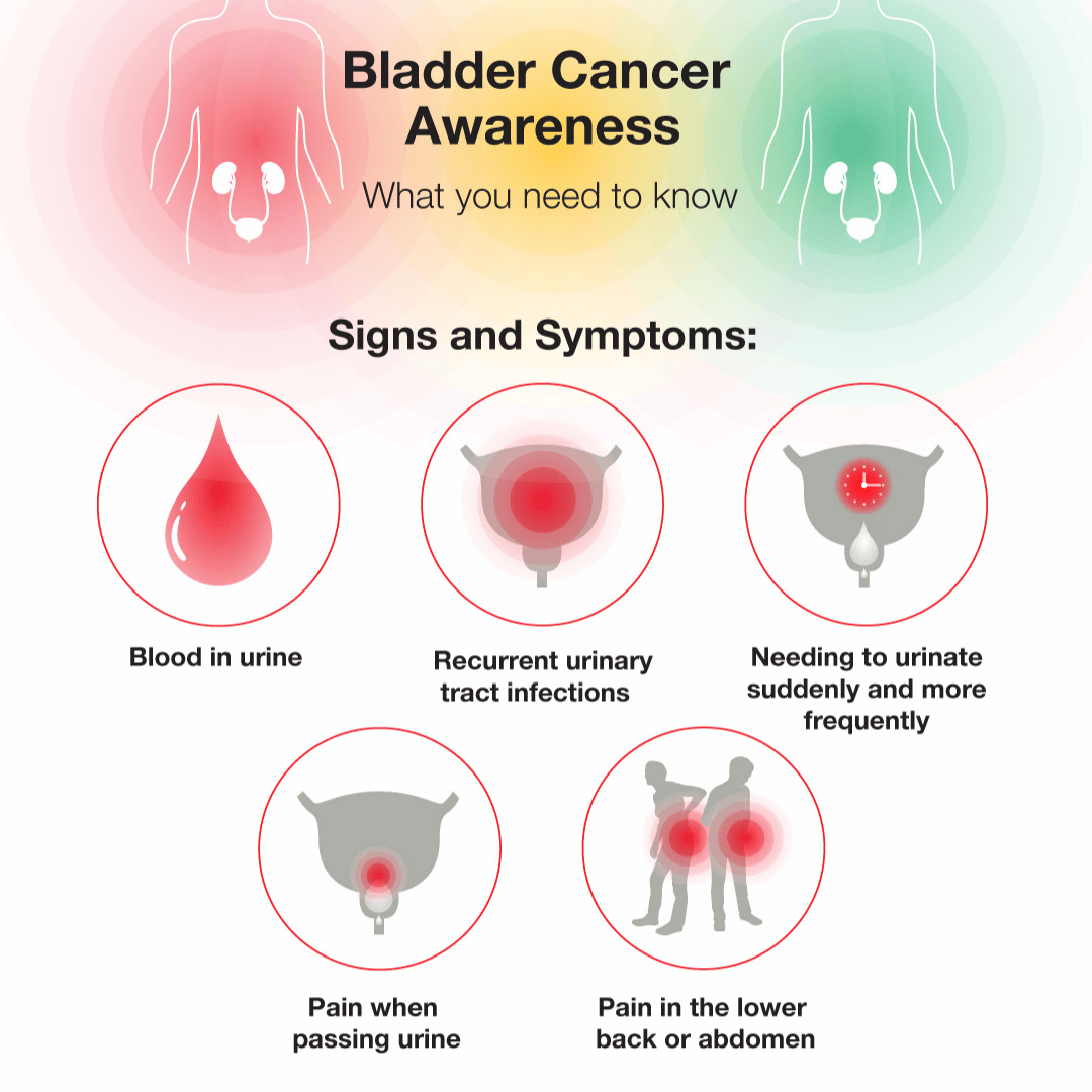 what were your first signs of bladder cancer ï¸? Updated Guide 2022