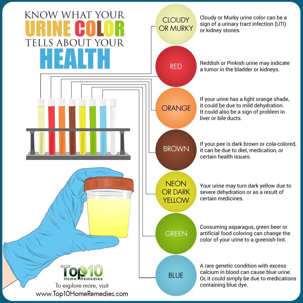 what your urine color tells about your health